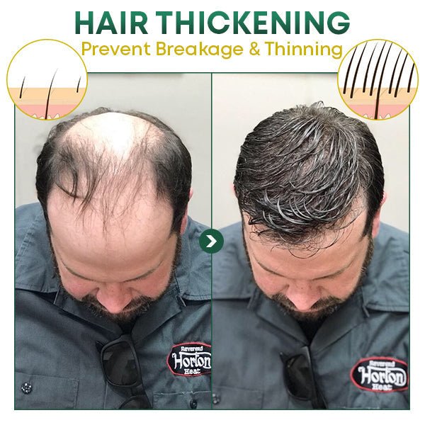 HaarVital™ - Fülligeres Haar auf natürliche Weise