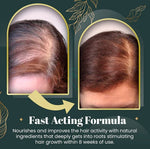 HaarVitalScrub™ - Stärke dein Haar von der Wurzel an!