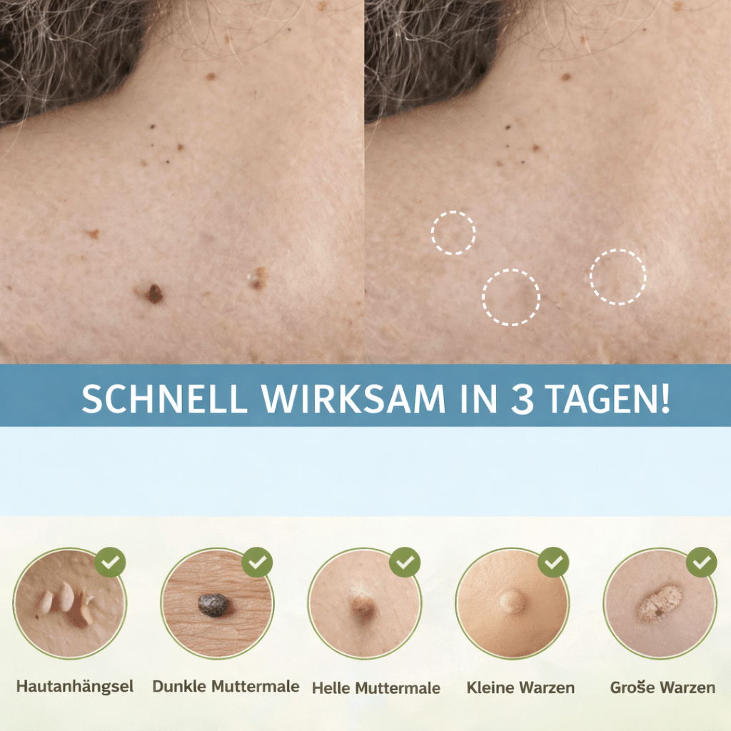Hautfaltenentferner | Schmerzfreies & natürliches Patch für die Anwendung zu Hause