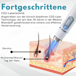 Hautverjüngungsgerät | Präzise Hautkorrektur | Sanfte Plasma-Technologie