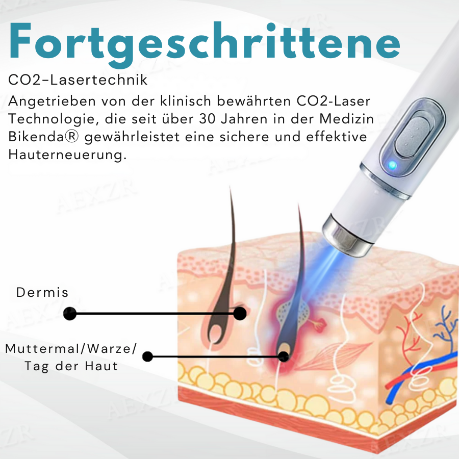 Hautverjüngungsgerät | Präzise Hautkorrektur | Sanfte Plasma-Technologie