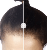 HaarVitalizer™ | Elektronischer Haarverjünger
