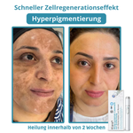 LumiSkin™ Lasergerät für schmerzfreie Hautverjüngung