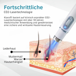 LumiSkin™ Lasergerät für schmerzfreie Hautverjüngung