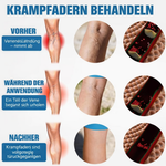 Belebendes Beinpflege-Spray | Schmerzfrei & Einfach Anzuwenden