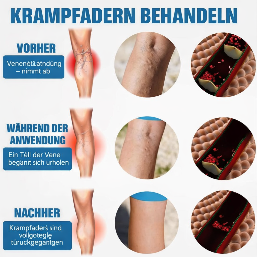 Belebendes Beinpflege-Spray | Schmerzfrei & Einfach Anzuwenden