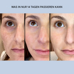 Hautstraffende Gesichtsstreifen | Sofortige Glättung & Festigung | Faltenpflege ohne Operation | GlanzLift