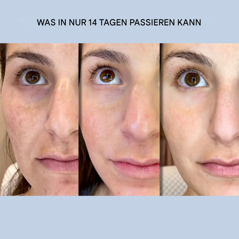 Hautstraffende Gesichtsstreifen | Sofortige Glättung & Festigung | Faltenpflege ohne Operation | GlanzLift