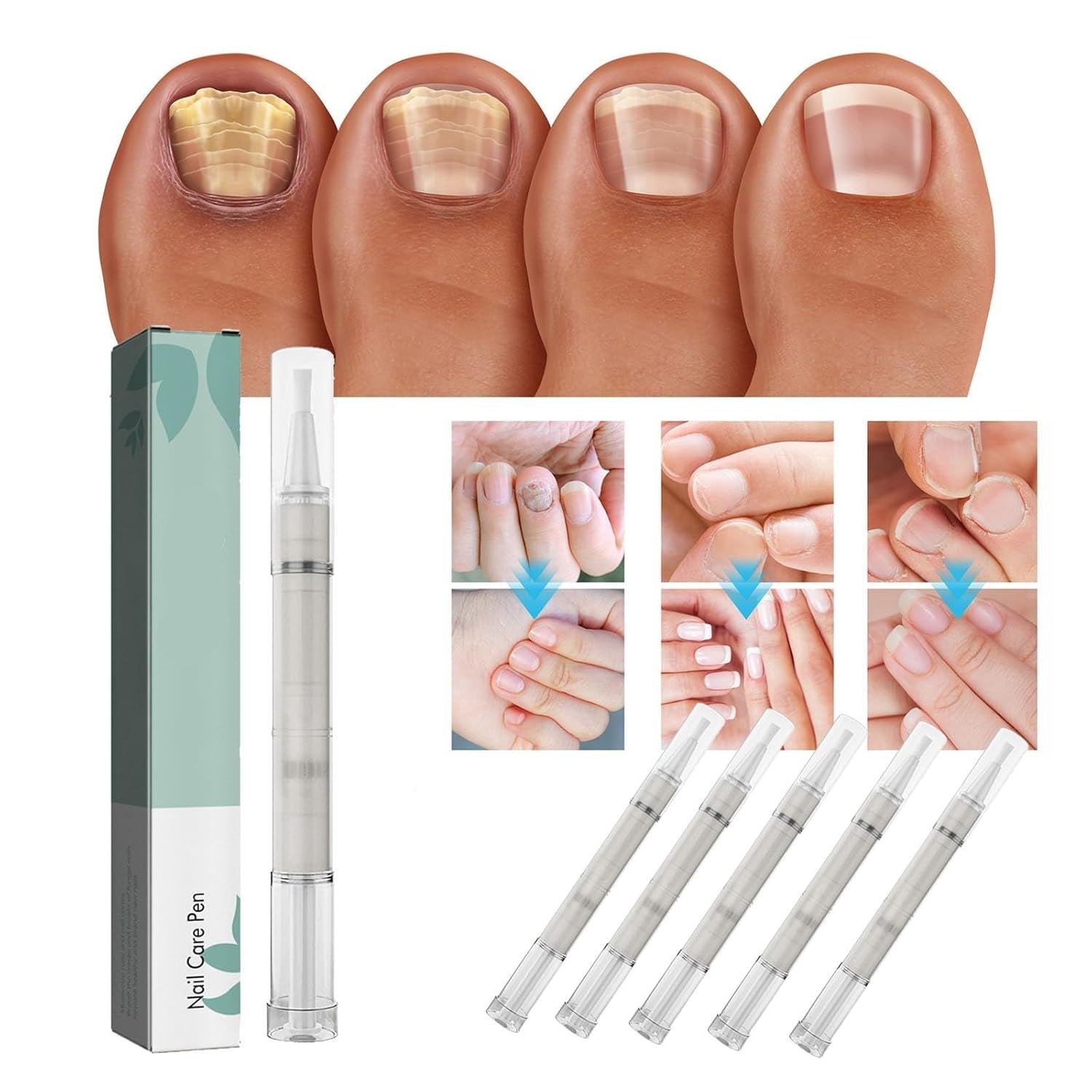 NailVital™ | Bio-Nagelpflege-Stift