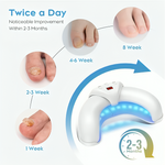 Pilzfrei | Effektive Lasertherapie für gesunde Nägel!