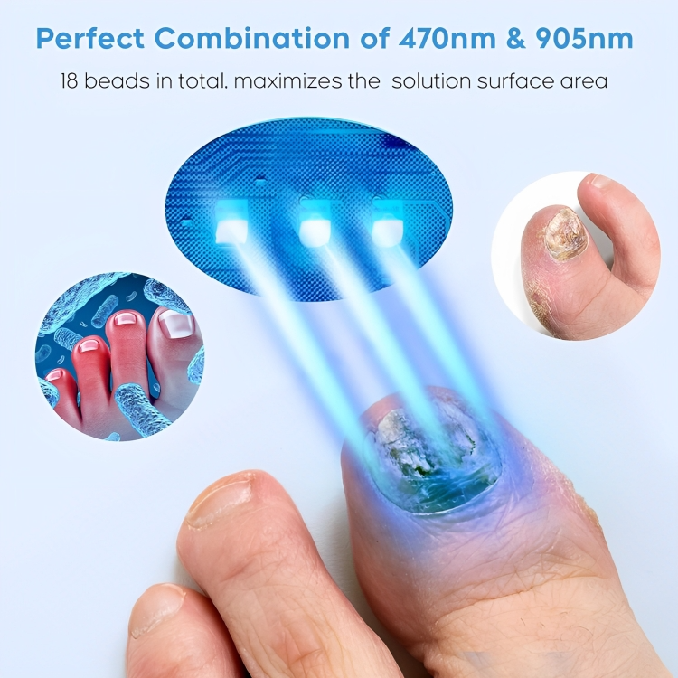 Pilzfrei | Effektive Lasertherapie für gesunde Nägel!