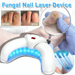 Pilzfrei | Effektive Lasertherapie für gesunde Nägel!