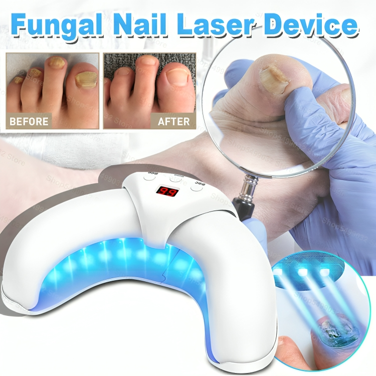 Pilzfrei | Effektive Lasertherapie für gesunde Nägel!
