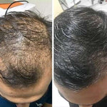 Stärkendes Shampoo für Haarwachstum und Vitalität