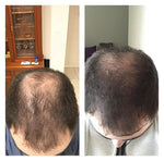 Stärkendes Shampoo für Haarwachstum und Vitalität