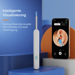 Intelligentes Ohrenscope | Ohrreiniger mit Kamera | Echtzeitansicht auf Smartphone