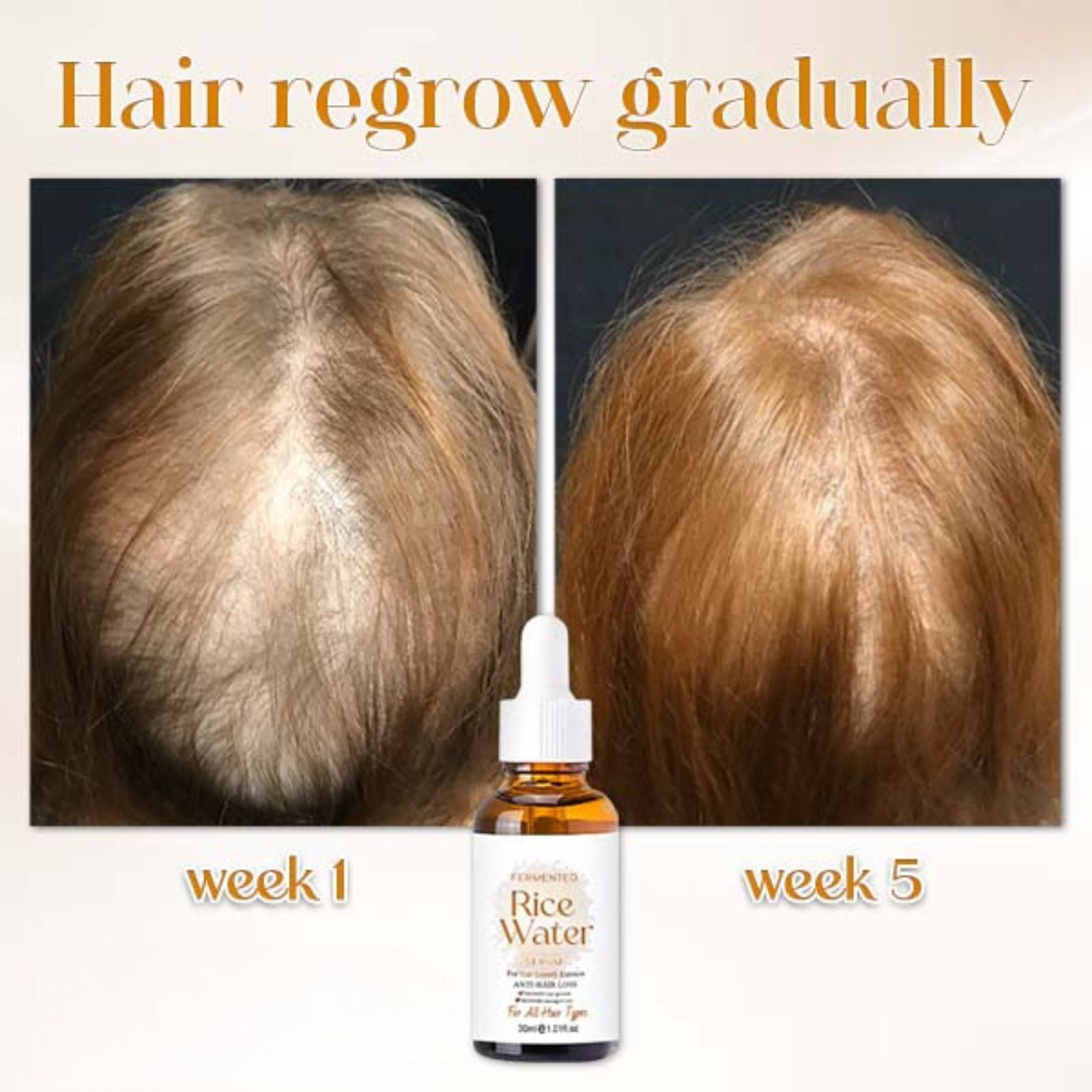 Naturserum für Haarwachstum | Fermentiertes Reiswasser