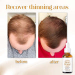 Naturserum für Haarwachstum | Fermentiertes Reiswasser