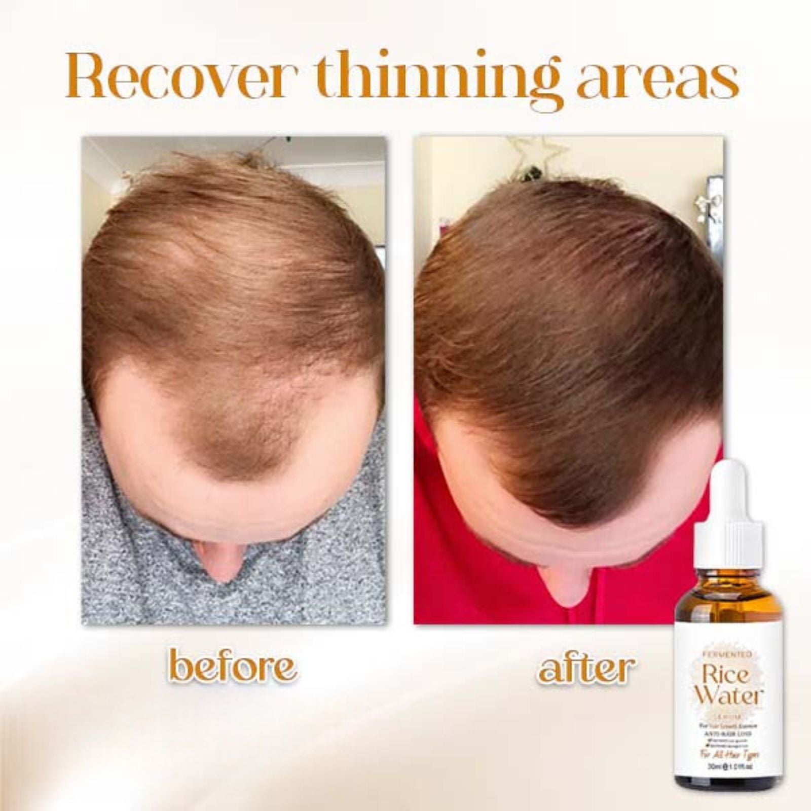 Naturserum für Haarwachstum | Fermentiertes Reiswasser