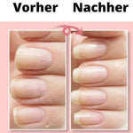 NailShield - Stärken Sie Ihre Nägel im Handumdrehen!