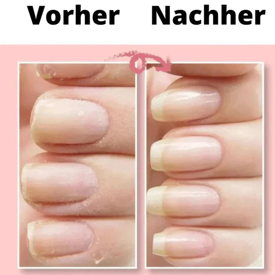 NailShield - Stärken Sie Ihre Nägel im Handumdrehen!