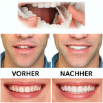 Schnelle, bequeme Zahnprothese für ein strahlendes Lächeln