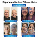Zahnersatz | Zahnreparaturset mit LED | Formbares Zahngel | SmileCraft