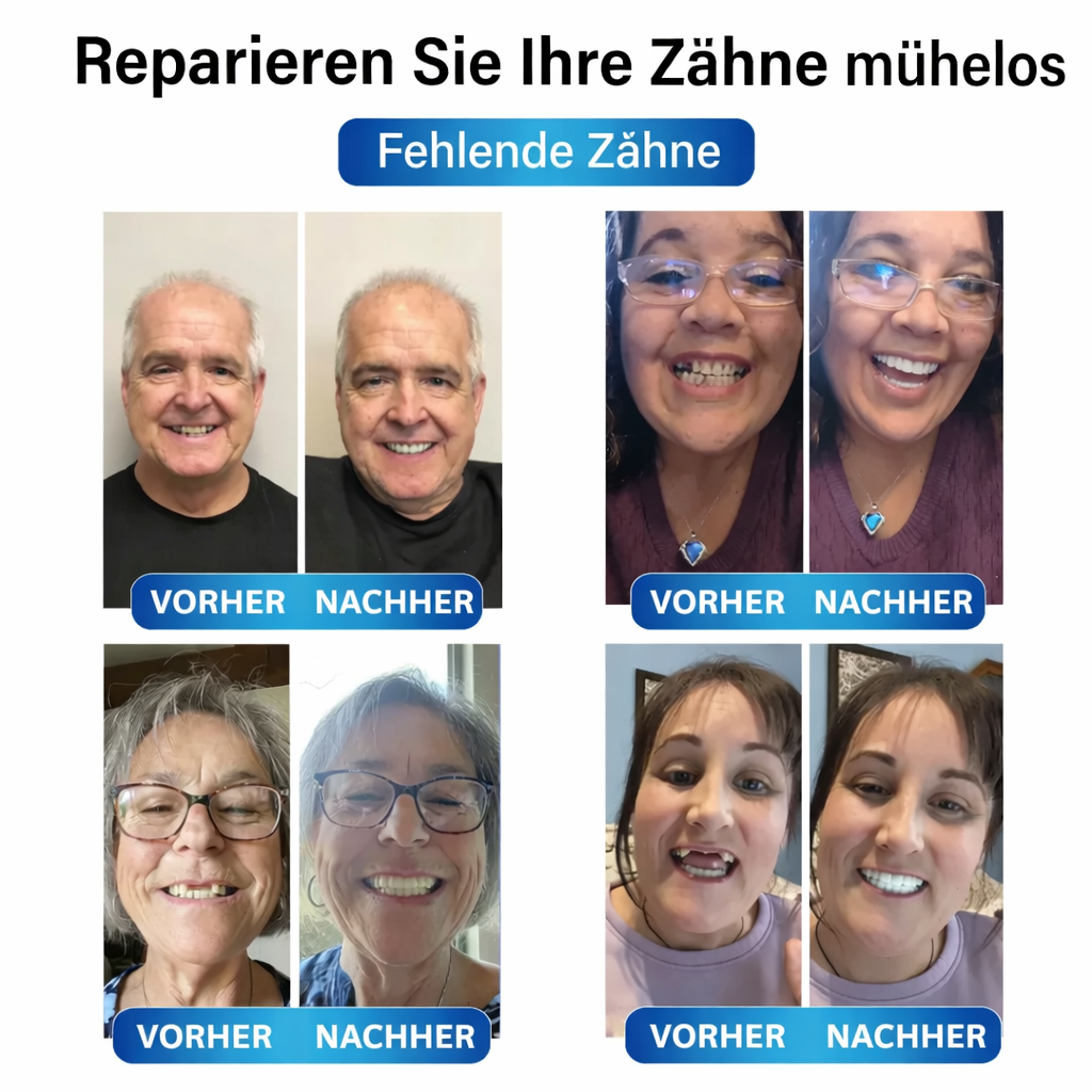 Zahnersatz | Zahnreparaturset mit LED | Formbares Zahngel | SmileCraft