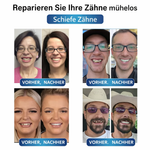Zahnersatz | Zahnreparaturset mit LED | Formbares Zahngel | SmileCraft