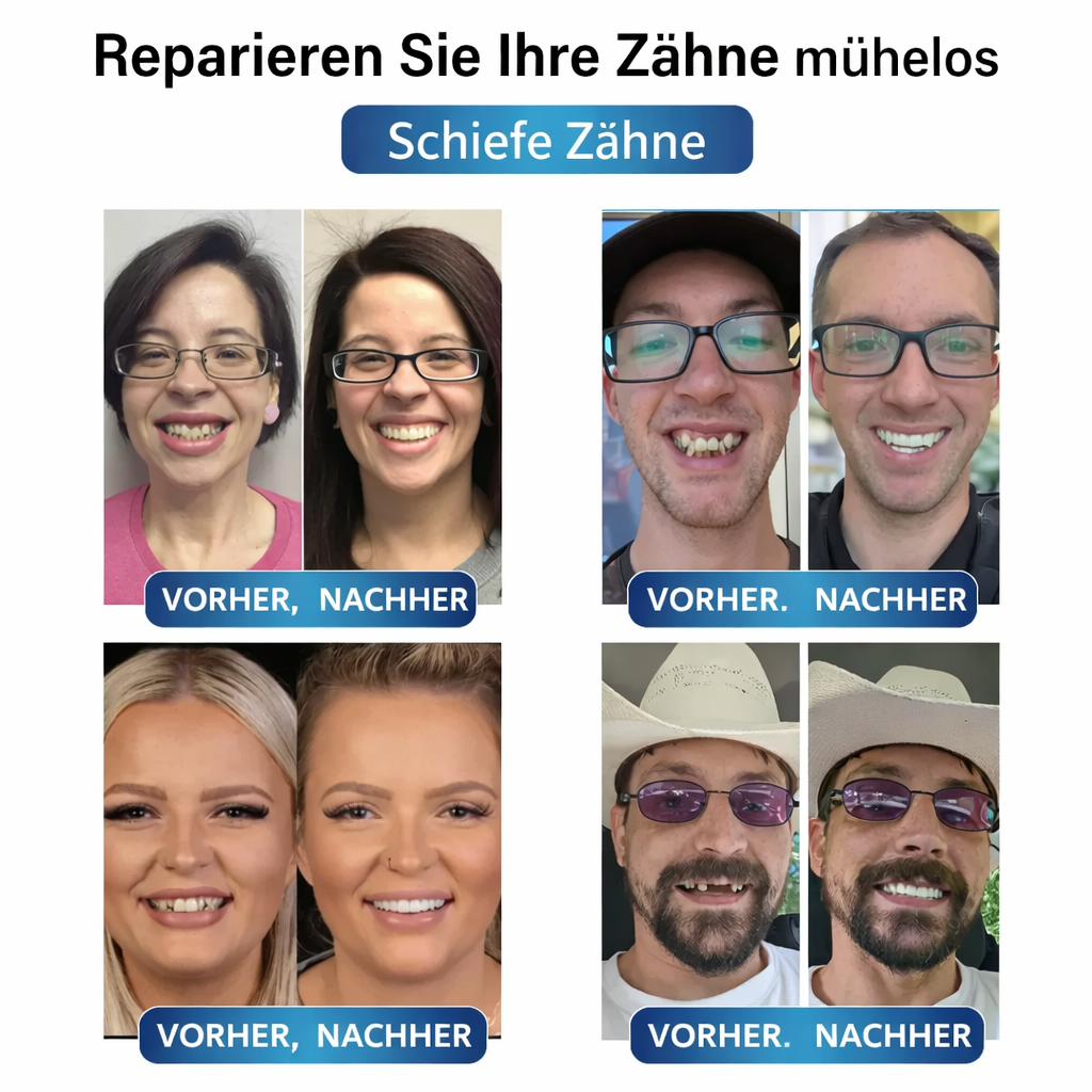 Zahnersatz | Zahnreparaturset mit LED | Formbares Zahngel | SmileCraft