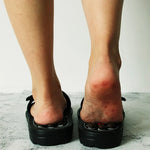 Acupressure Slippers Rotating Pressure Nodes
