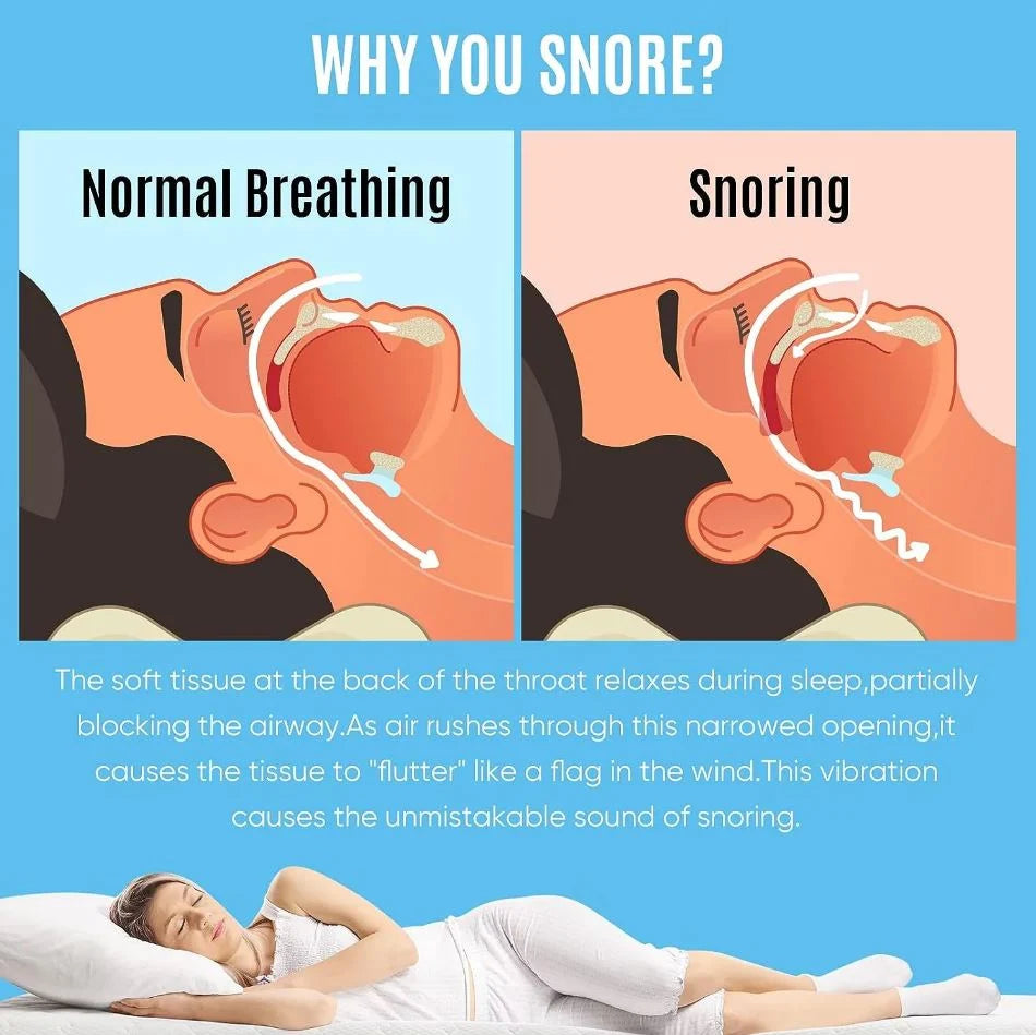 Anti-Snore Mouthpiece Adjustable Jaw Medical-Grade Silicone