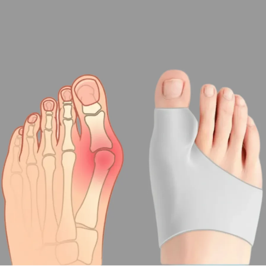 Bunion Corrector Adjustable Breathable Set of 2 Pairs