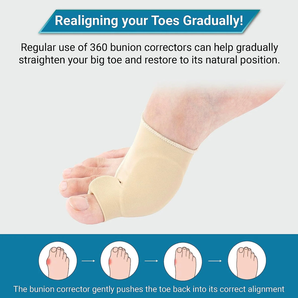 Bunion Corrector Medical-Grade Gel Sleeve & Toe Spacer