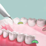 Dental Cleaner Ultrasonic Cordless 5 Intensity Levels