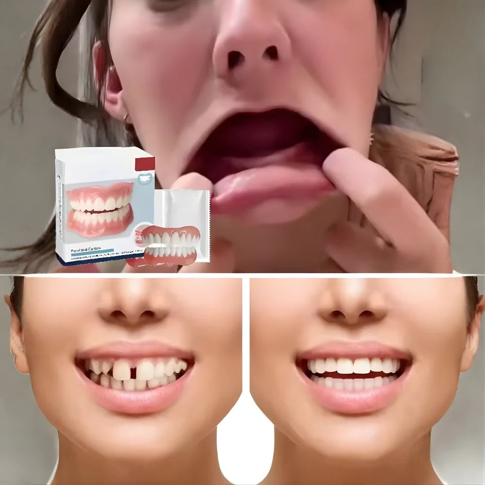 Denture Set Moldable Resin Upper & Lower