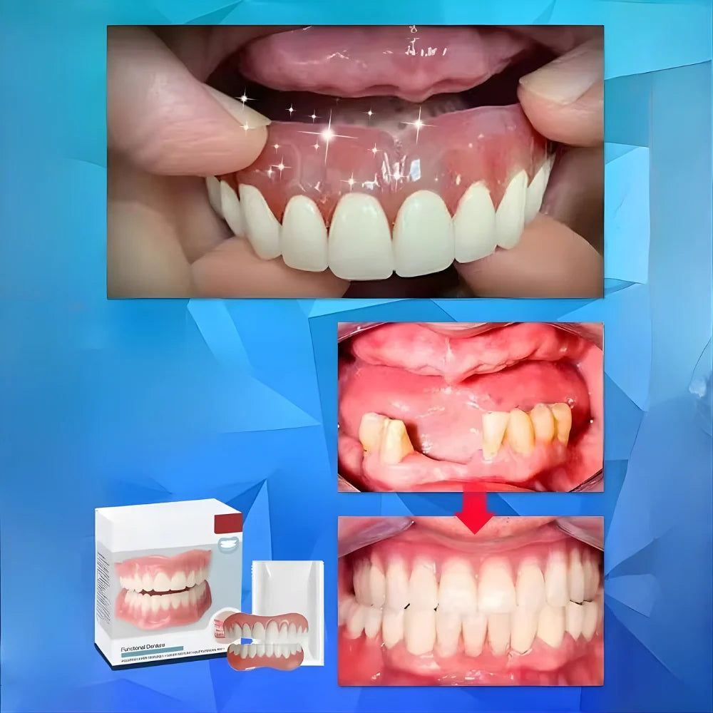 Denture Set Moldable Resin Upper & Lower
