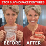 Denture Set Moldable Upper & Lower At-Home Fitting Kit