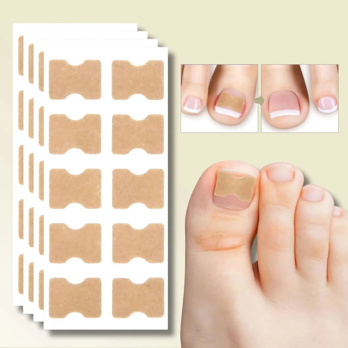 Ingrown Toenail Patches Flexible Elastic Peel-and-Stick 20 Count