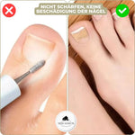 Ingrown Toenail Patches Flexible Elastic Peel-and-Stick 20 Count