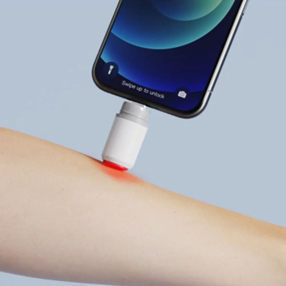 Mosquito Bite Relief Pen Instant Itch Relief USB Rechargeable