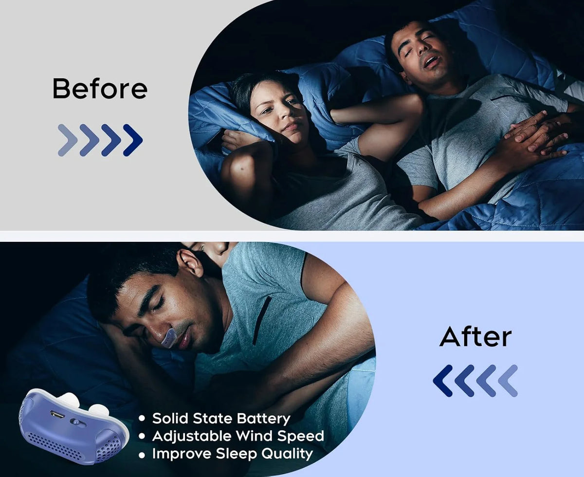 Nasal Breathing Aid USB Rechargeable Soft Silicone Buds
