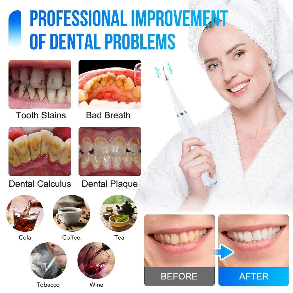 Ultrasonic Tooth Cleaner Waterproof 3 Interchangeable Heads