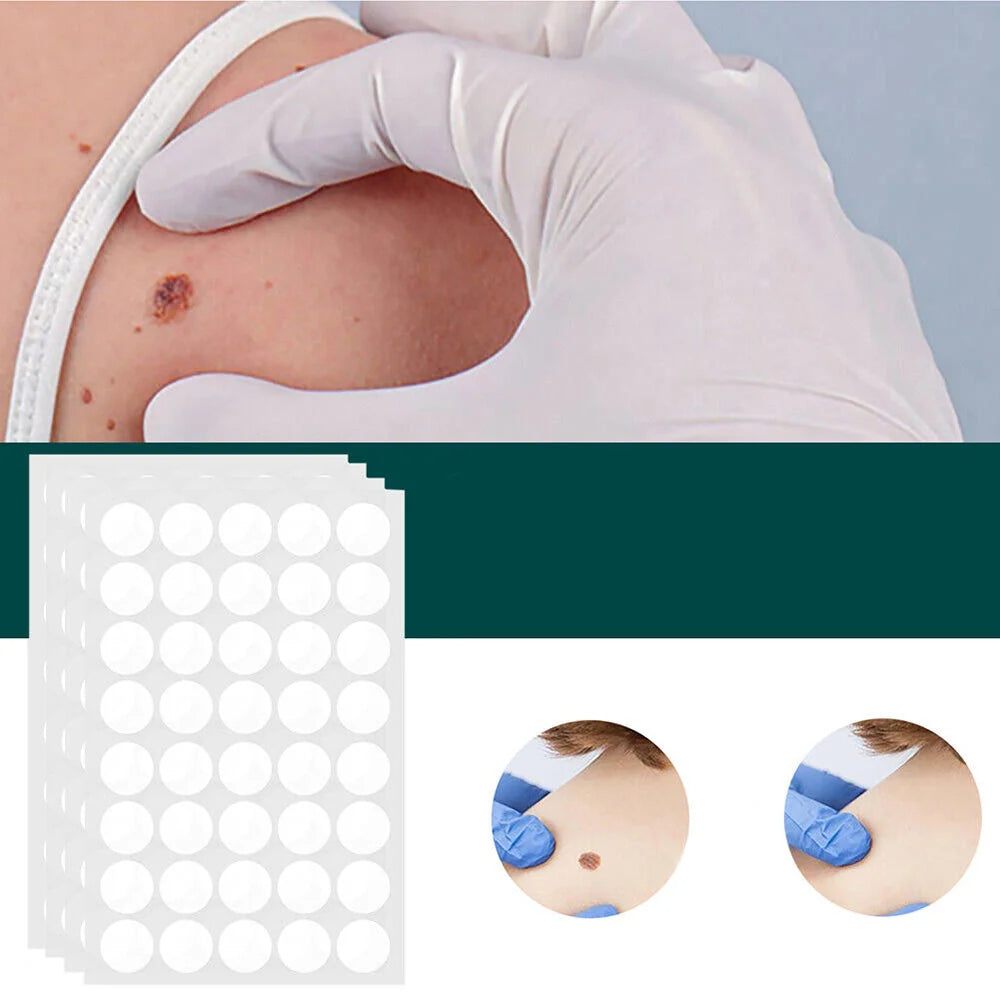 Wart Removal Patches Hydrocolloid Transparent Set of 120