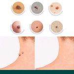 Wart Removal Patches Hydrocolloid Transparent Set of 120