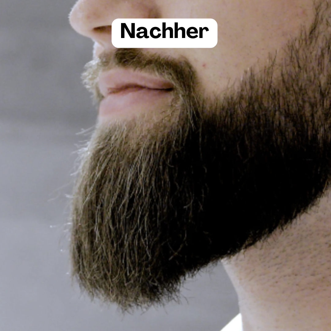 Elegant Beard Styler | Cordless Device for a Flawless Look
