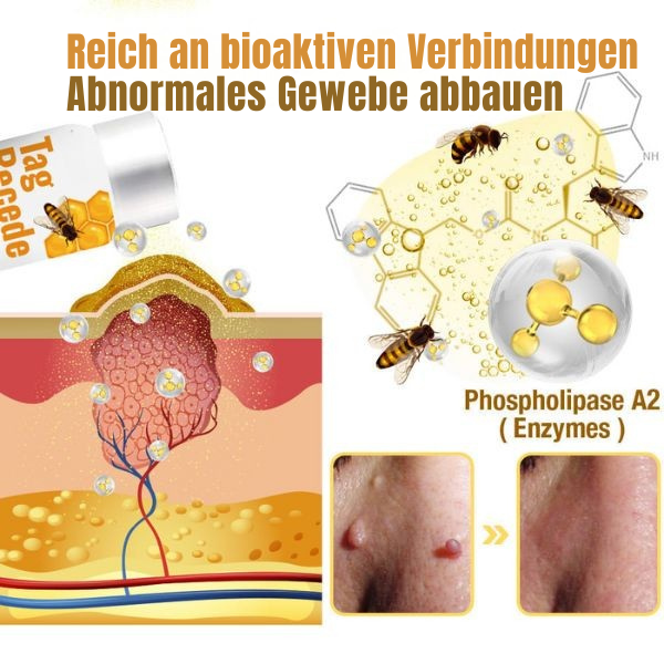 Hautpflegemittel gegen Hautunreinheiten | Schmerzarme Anwendung | Bienenstich-Formel