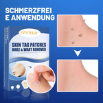 Hautfreundliche Entferner-Pflaster | Sanfte Lösung für Hautunreinheiten
