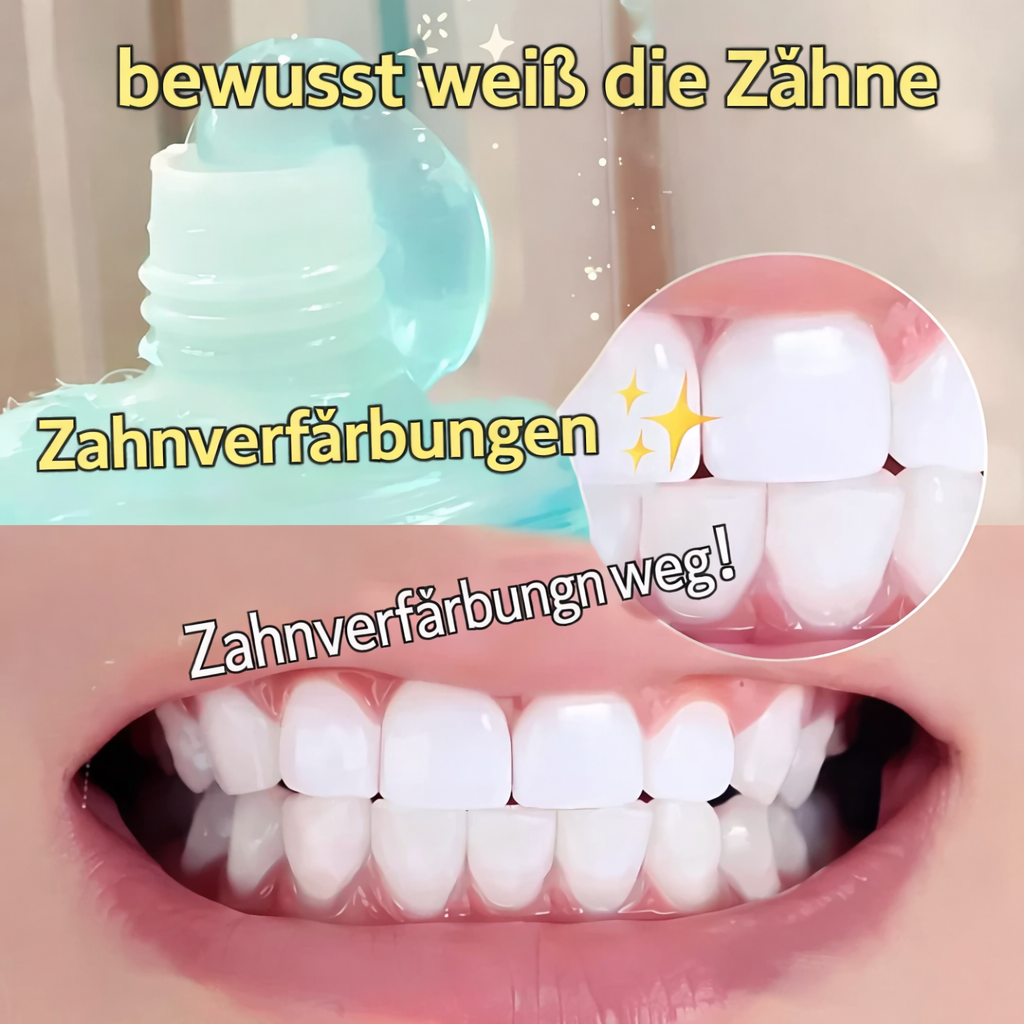 Zahnpasta für strahlend weiße Zähne | Niacinamid-Formel | Sanfte Fleckenreduzierung