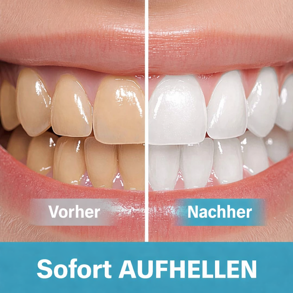 Zahnaufhellungsstift | Sofortige Aufhellung für Ihr Lächeln | Sensible Zähne, sanfte Formel